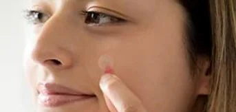 Patch anti-acné Nexcare™
