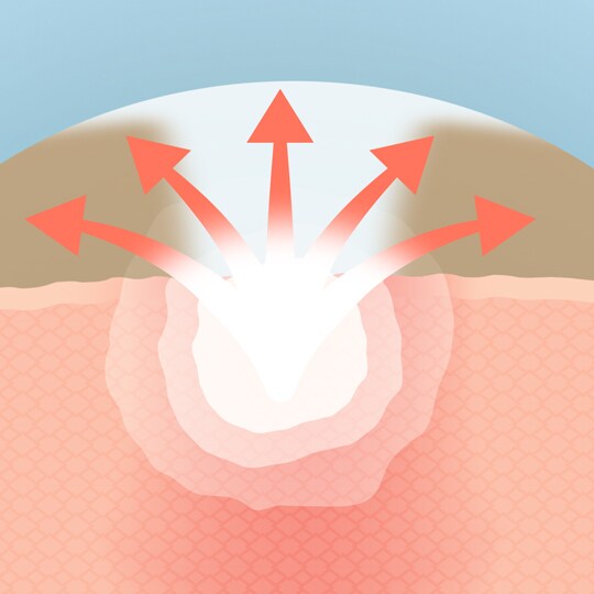 infobulle 2